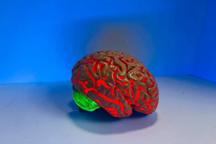 El cerebro de los hombres envejece peor, pero ellas desarrollan más Alzheimer: una paradoja que desconcierta a los científicos
