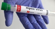 Namibia Declares Mpox Outbreak in Swakopmund, Launches Emergency Health Response