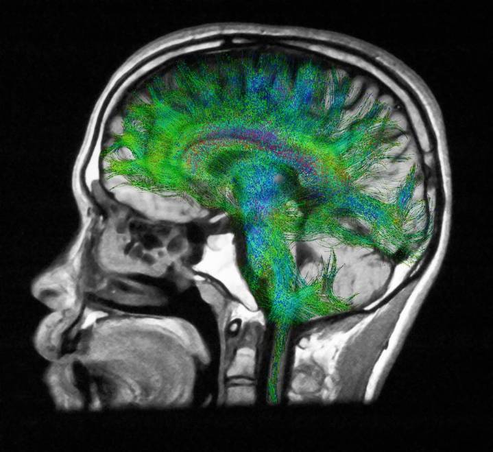 What Really Drives Hunger And Fullness: The Science Explained