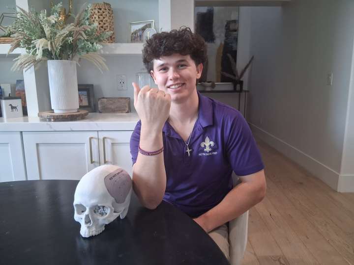 Scottsdale student over comes brain injury from playing football to coach team