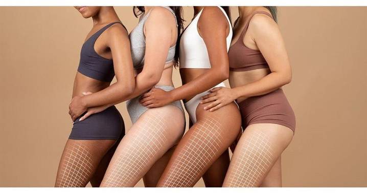 From cellulite to sculpted: The non-invasive solution everyone is talking about