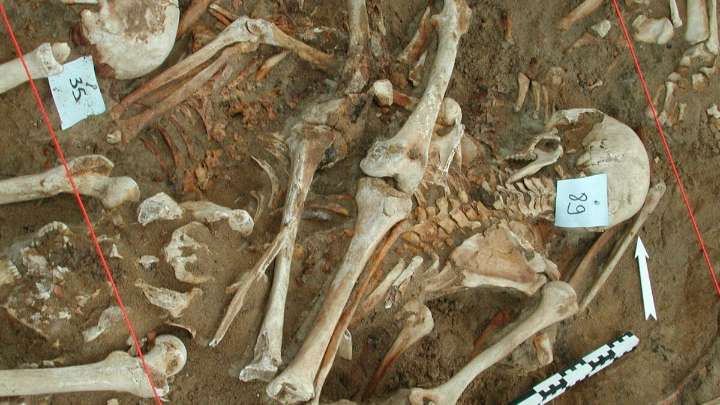 What killed Napoleon's army? Scientists find clues in DNA from fallen soldiers' teeth