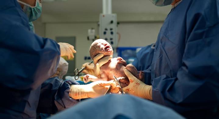C-Sections Linked to More Pain and Poorer Sleep for New Moms