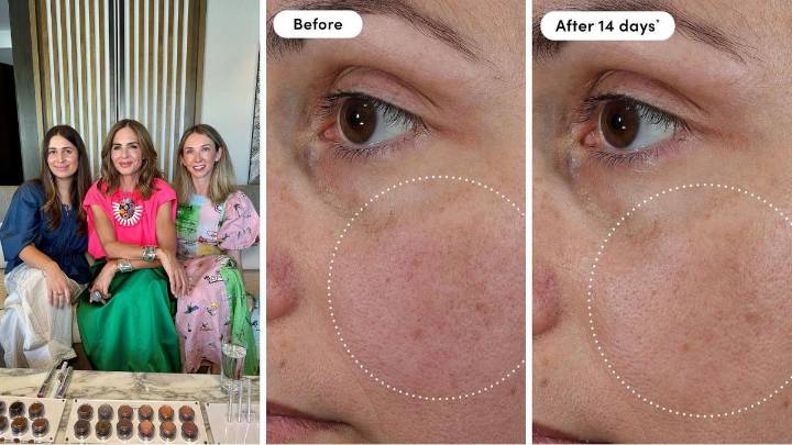 Trinny London drops revolutionary vitamin C serum you can use every day for glowing skin: ‘Vitamin C on steroids’
