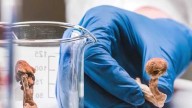 Florida researchers run trials on magic mushrooms for postpartum depression