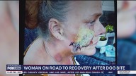 Caregiver recovering after dog mauling in Cocoa