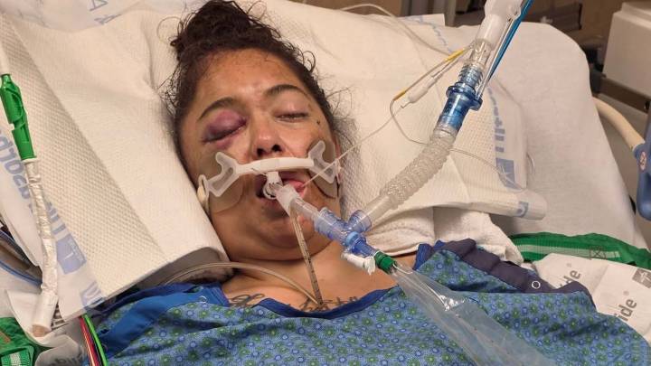 'I Shot Her': Gillette Woman Shot In Head Remains On Life Support, Man Charged