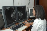 Adelante exige a Beardo que actúe “ante los retrasos en los diagnósticos de cáncer de mama”