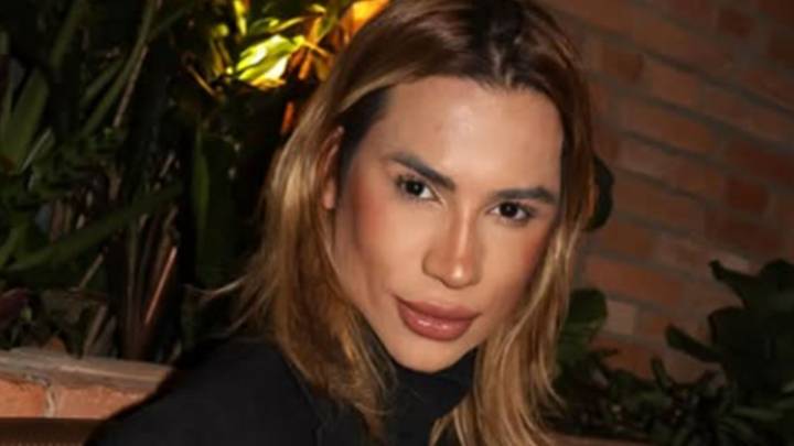 ¿Qué es y cuánto cuesta un Foxy eyes, que provocó la muerte del influencer Dutra Junior?
