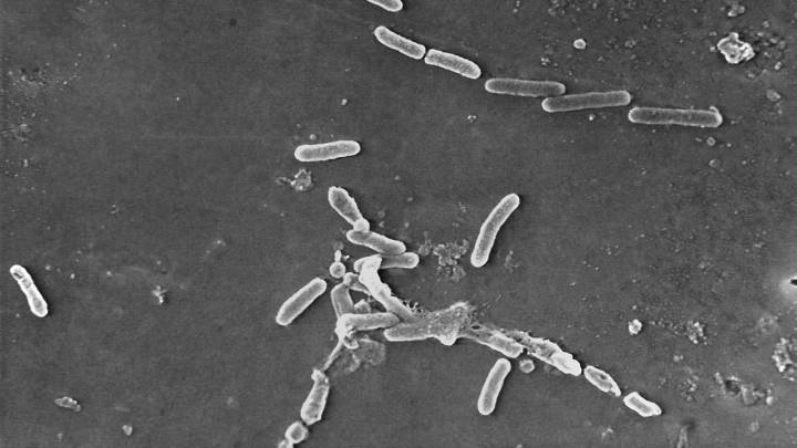 Drug-resistant superbugs' spread surging, World Health Organization warns