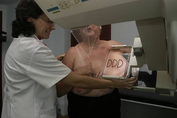 Un nuevo tratamiento da mejores resultados que el estándar en cáncer de mama metastásico