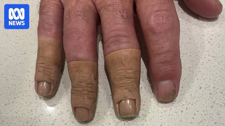 Prosthetics clients of Jack McDonald question what legal rights they have for compensation