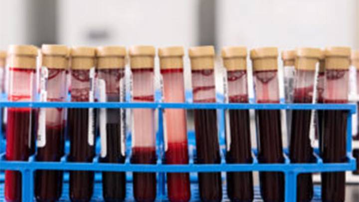 Groundbreaking blood test can detect more than 50 cancers, Bay Area biotech says