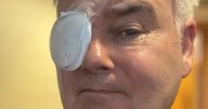 Eamonn Holmes says 'you should see the other guy' after being rushed to hospital in health update