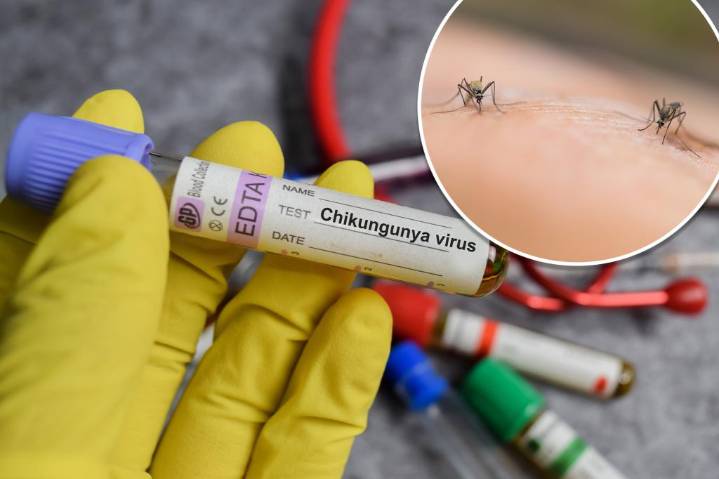 New York health officials confirm state's first locally acquired case of chikungunya virus