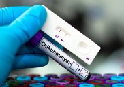 Chikungunya, la dolorosa fiebre que se hace global por los viajes y el cambio climático