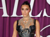 Kim Kardashian mostró que tiene un aneurisma cerebral y dice que es culpa de Kanye West, su ex
