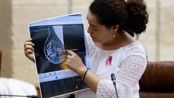 La Fiscalía de Sevilla investiga si se modificaron historiales médicos del programa de detección de cáncer de mama