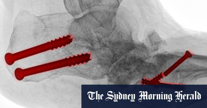 Podiatric surgeons to get new title of surgical podiatrists after patient confusion