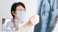 Pneumonia Alert: How a Simple Cold Can Turn Deadly, Know Early Warning Signs