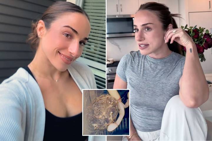 Shocking photo reveals horrifying 'gerbil-like' HAIRBALL dragged out of woman's vagina by her IUD