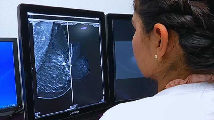Chihuahua Registra 237 Defunciones por Cáncer de Mama en lo que Va del Año