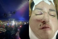 Denuncia negligencia mujer lesionada por caída de estructura de una tonelada en circo
