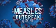 More cases of measles confirmed in SC