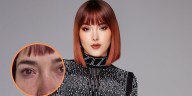 Kika Nieto confesó que tiene un ácaro viviendo en su ojo y habló del problema ocular que le causó: “Asqueroso”