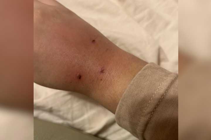 Woman Gets Bitten by a ‘Street Cat,’ Horror at What Happens Next