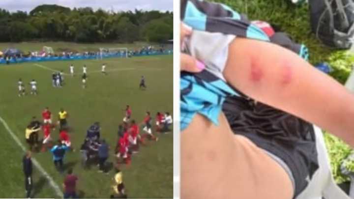 Árbitro agredido por jugadores y cuerpo técnico de América de Cali Sub-17 en el Torneo de las Américas está hospitalizado