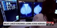 30% of Nebraska women missing breast cancer screenings
