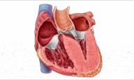 Diabetes Significantly Worsens Outcomes in Hypertrophic Cardiomyopathy, Meta