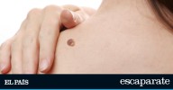 Buenas noticias para los que tienen verrugas: este kit superventas en Amazon ofrece un tratamiento para quitarlas de forma rápida y efectiva