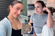 Shocking photo reveals horrifying 'gerbil-like' HAIRBALL dragged out of woman's vagina by her IUD