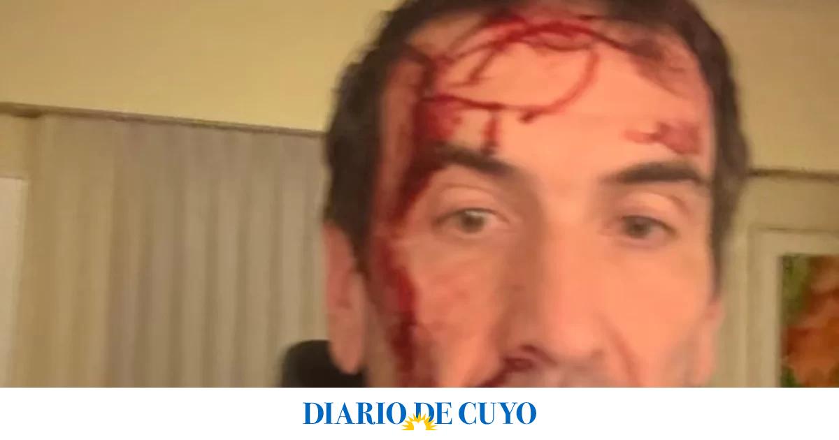 Asaltaron y golpearon al candidato a senador libertario Pablo Cervi: “Le gatillaron varias veces”