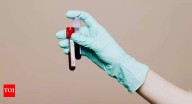 Not just cholesterol: This overlooked blood test can signal stroke risk