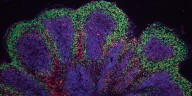 Científicos de Stanford logran fabricar en laboratorio miles de mini cerebros mediante un aditivo alimentario común