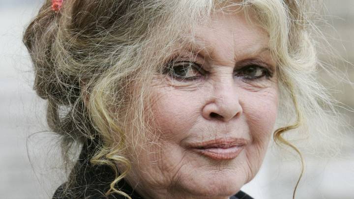 Brigitte Bardot Is in a “Worrying State” After a 3