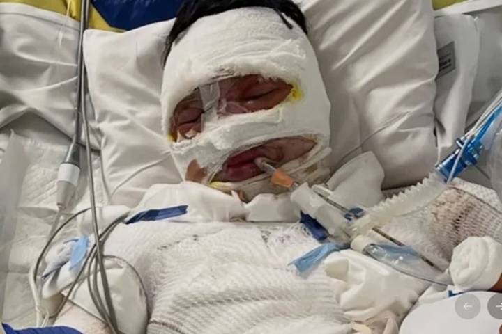 19-Year-Old Man Set on Fire amid Alleged ‘Ongoing Feud’