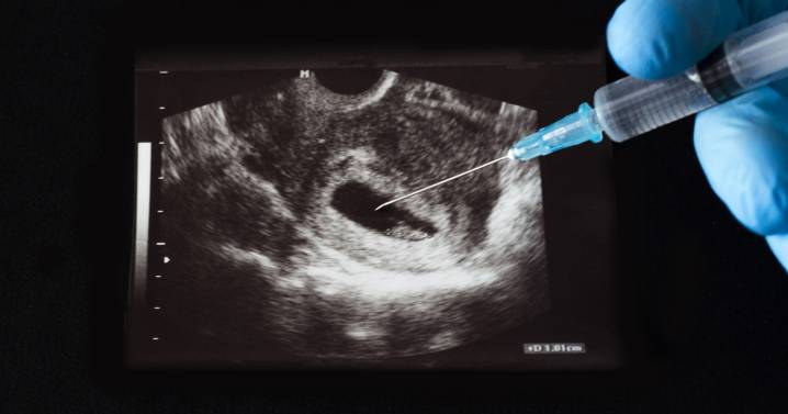 Asociaciones provida acusan al Gobierno de manipular la Constitución para blindar el aborto