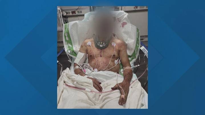 Man suing ex-NFL QB Mark Sanchez, FOX Corporation after Indianapolis stabbing