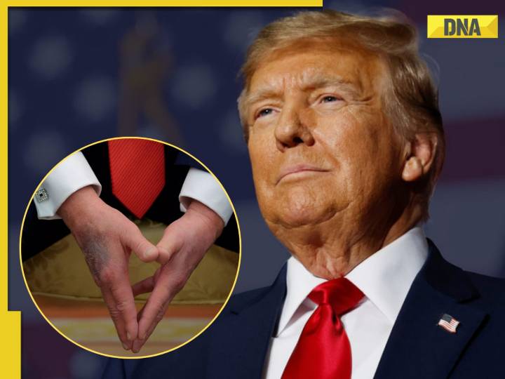 Donald Trump's doctor issues MAJOR update on his health after hospital visit