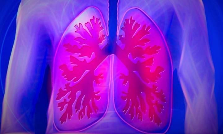 Sarcoidosis Patients at Higher Risk of Psychiatric Symptoms, Meta