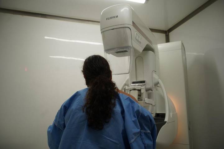 Anótelo en la agenda: desplegarán servicios contra el cáncer de mama