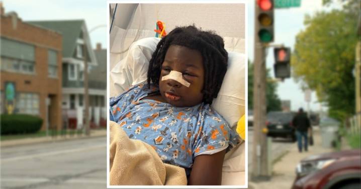 8-year-old Milwaukee boy severely injured in hit-and-run while walking home from school