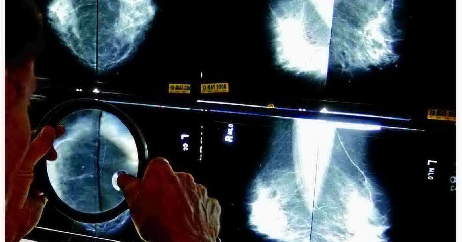 Detect breast cancer early with mammograms