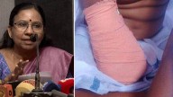 Amputation of nine-year-old girl's arm: No medical error, says Hospital superintendent