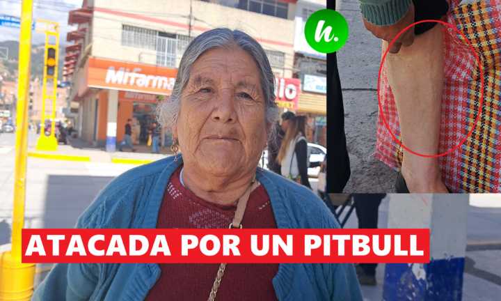 Feroz ataque de pitbull deja mujer herida