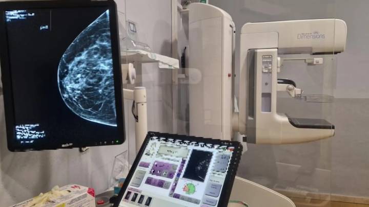 Casi 10.500 altoaragonesas han participado en el cribado de cáncer de mama en Aragón